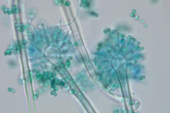 Mikroskopische Aufnahme von Schimmelpilzen